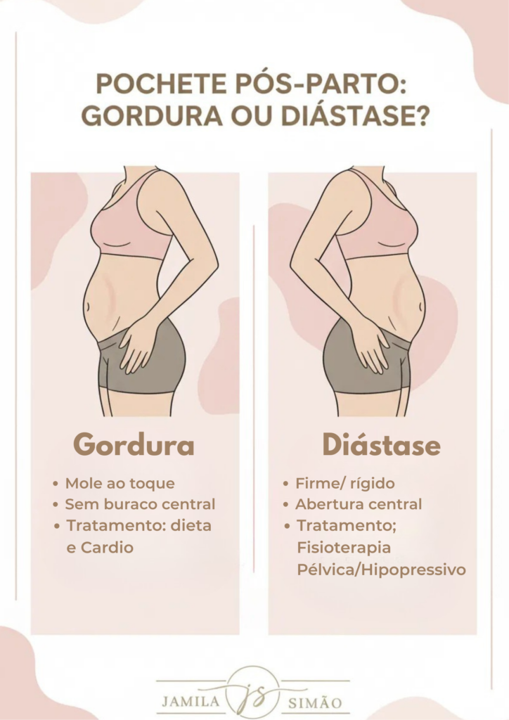 Infográfico comparando a pochete pós-parto causada por gordura versus a causada por diástase abdominal.