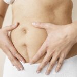 diastase abdominal