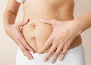 diastase abdominal