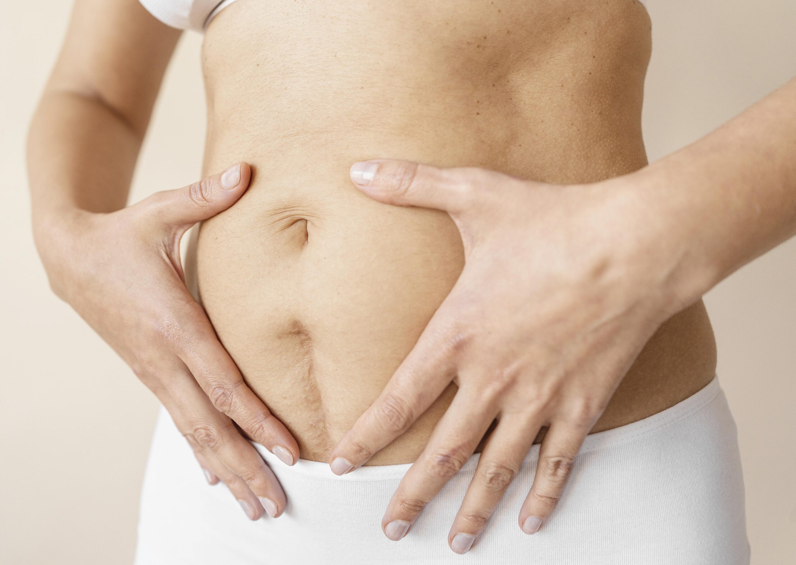 diastase abdominal